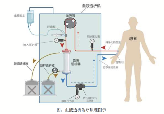 年入34亿元，“中国血透之王”威高血净又要IPO敲钟了！